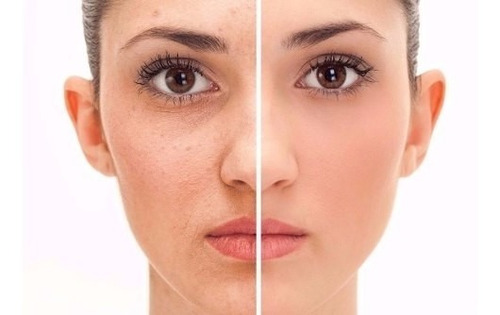 Crema Reafirmante Facial Y Corporal Antiarrugas Con Elastina