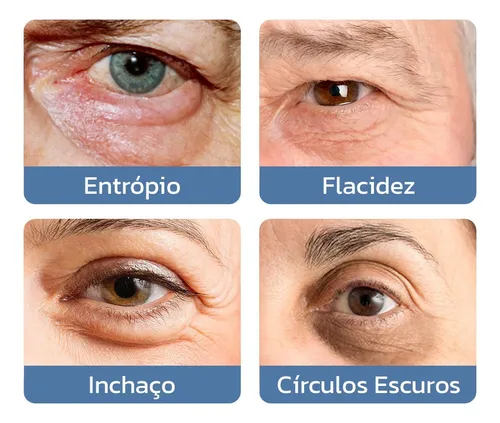 Avocare Creme Reparador De Pálpebras Saudáveis Em Segundos | Parcelamento sem juros