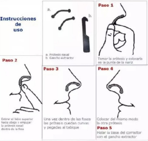 Imagen 9 de 10 de Corrector Nasal Incluye 6 Repingador + Extractor