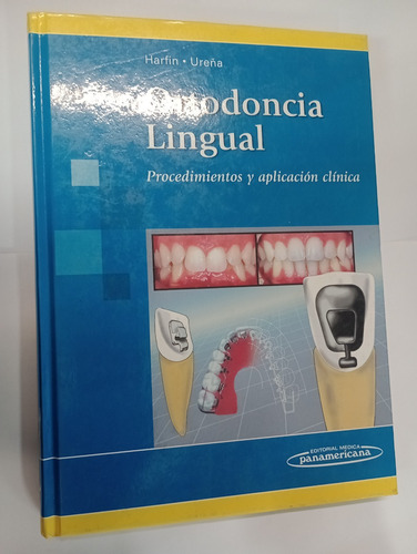 Ortodoncia Lingual - Harfin - Ureña