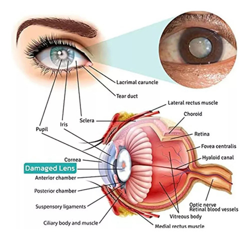 Z Rodillo De Masaje Vision Enhance, Masaje Ocular Para