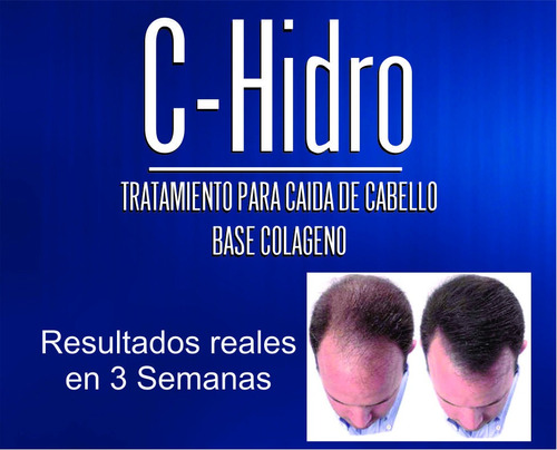 Shampoo Caida Cabello De Colageno!!!