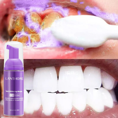 Imagen 7 de 9 de Kit De Blanqueamiento Dental Blanc Oral Care De 4 Unidades