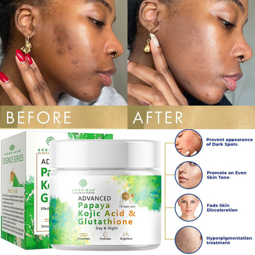 Nourishing Best Skin Kójic & Cream Resurfacing Acid Fade