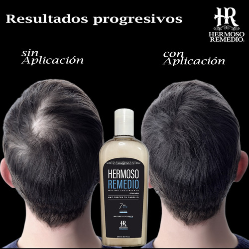 Imagen 5 de 8 de 6 Shampoo Anticaida Crecimiento Caspa Reparador Hombre 7en1