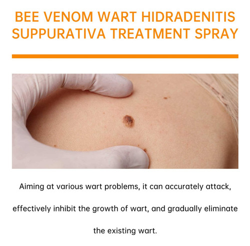 . Venom, Aerosol Antiverrugas Boomoon Bee Venom, Reparador