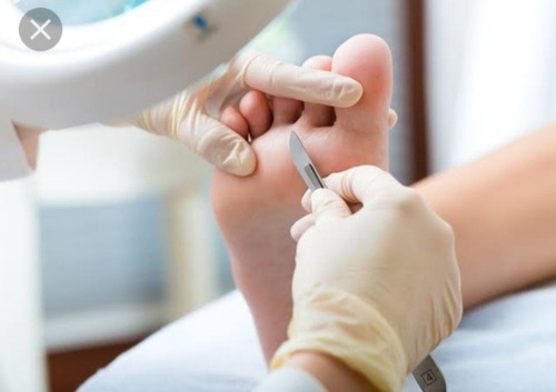 Imagem 1 de 3 de Podologia Katia Pinheiro, Saúde Dos Seus Pés. Footcare Trat.