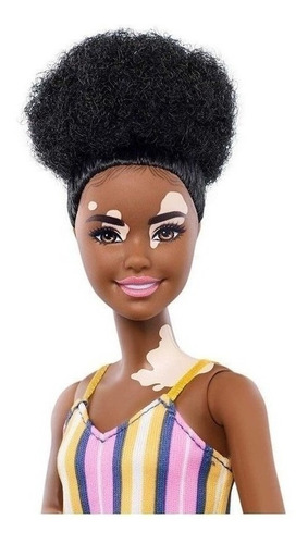 Imagem 3 de 12 de Combo Barbie 135 Vitiligo + Chelsea Morena Ms Sj