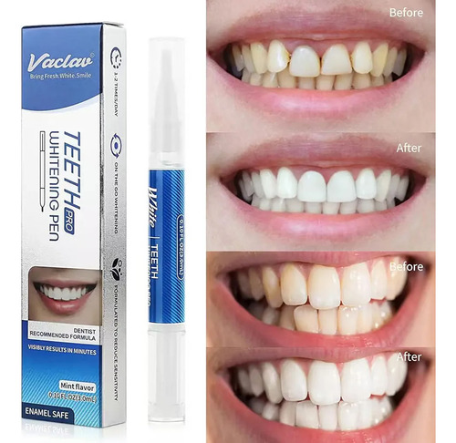 Pluma Blanqueadora Dental Rotativa