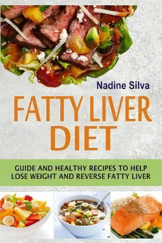 Fatty Liver Diet : Guide And Healthy Recipes To Help Lose Weight And Reverse Fatty Liver, De Nadine Silva. Editorial Createspace Independent Publishing Platform, Tapa Blanda En Inglés