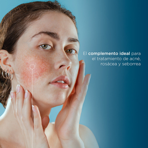 Cuteral Suplemento Alimenticio Antiacné Nicotinamida 30 Tabs