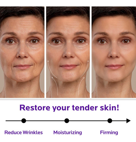 Crema De Retinol De Celo Para Cara Con Vitamina E - Br6se