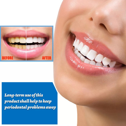 Bolígrafo Blanqueador De Dientes, Den Whitening Essence