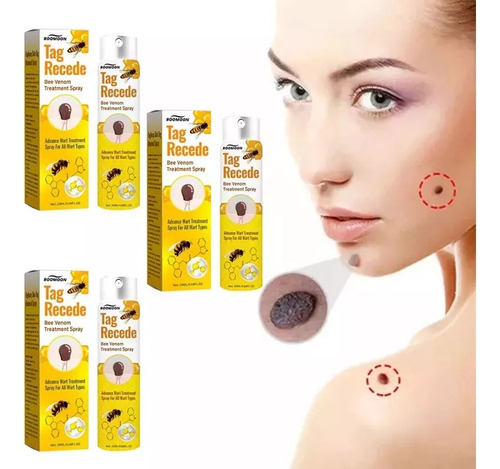 17- A 3pcs Tag Recede Bee,tag Recede Bee Spray For Mujeres Y