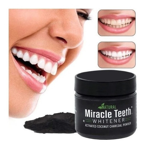 Blanqueamiento Dental Miracle Teeth - Globalchile