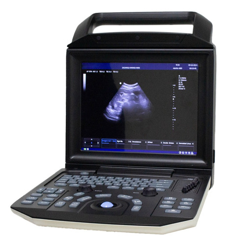 Ecógrafo Ultrasonido Médico Color Doppler  M5 +1 Transductor