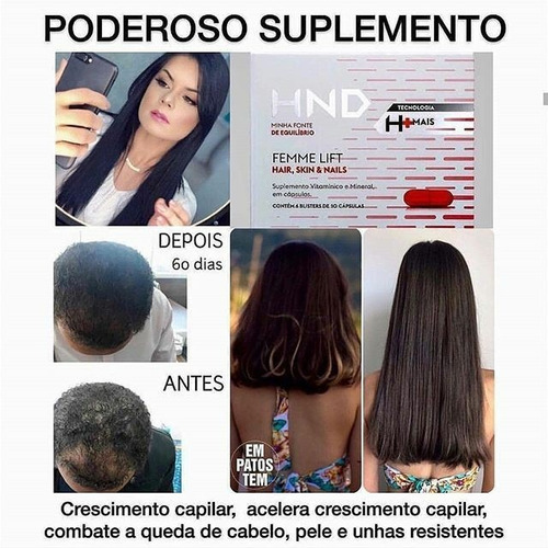 Imagem 5 de 5 de Produtos Hinode Originais