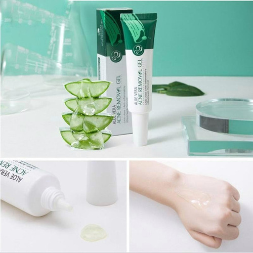 El gel de aloe vera elimina el acné y los puntos negros y es antiinflamatorio