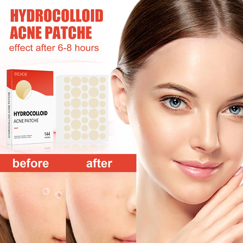 Parche Hidrocoloide Para Acné Y Espinillas Para Tratamiento