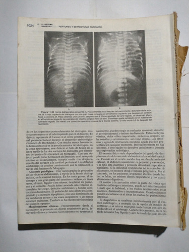 Tratado De Pediatria By Nelson (roto E Incompleto) Novena Ed
