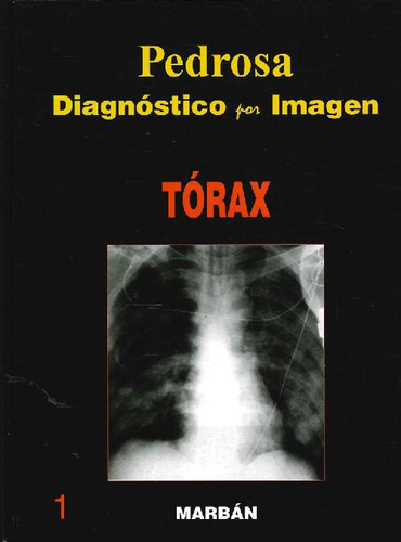 Libro Pedrosa Diagnóstico Por Imagen Tórax 1 De Cesar S Pedr