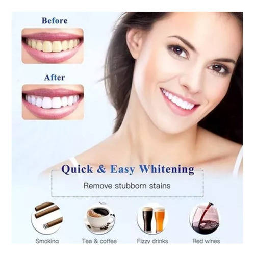 Gel Protector Gingival Profesional For Blanqueamiento