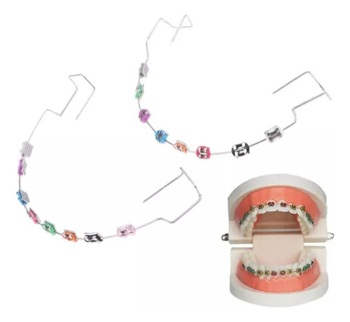 Un Par Decoración Dental Temporal De Ortodoncia Con Cables
