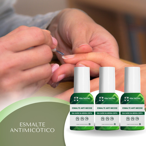 Kit 3 Esmaltes Anti Micose 1% 8ml Antimicotico