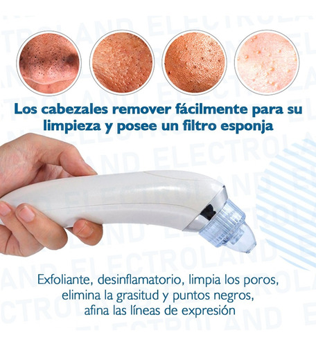 Imagen 6 de 10 de Microdermoabrion Puntos Negros Peeling Punta Diamante Recarg