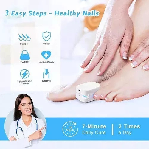 Laser Para Quitar Hongos De Las Uñas. Onicomicosis Láser