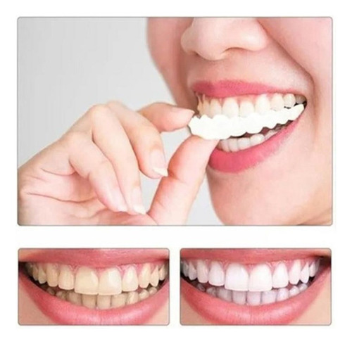 Mox Silicona Superior/inferior Sorriso Dentes Falsos