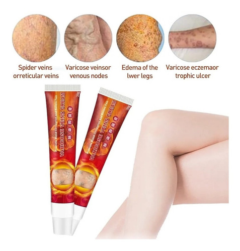 Sumifun - 2 Cremas Para Flebitis, Venas Varicosas, Varices