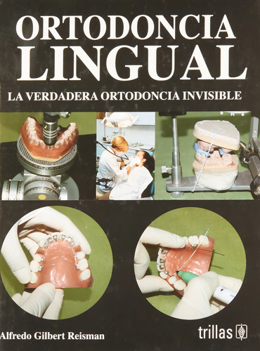 Reisman Ortodoncia Lingual La Verdadera Ortodoncia Invisible