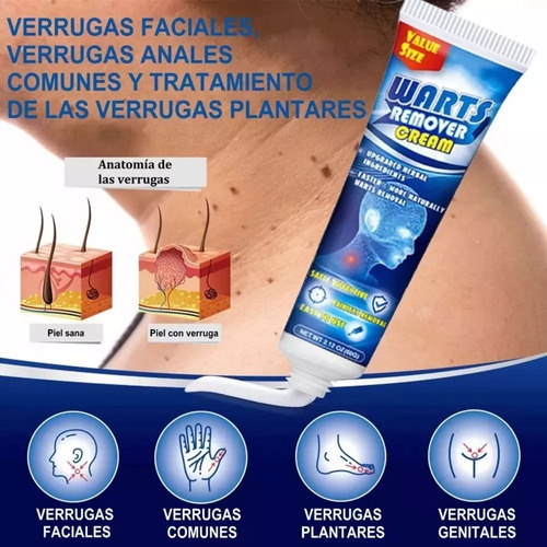 . 2 Pomadas De Maíz Y Crema Para Verrugas De 60 G