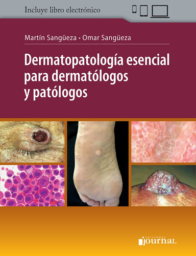 Dermatopatologia Esencial Para Dermatologos Y Patologos - Sa