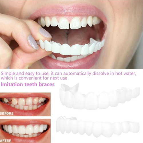 // 1 Par De Carillas Dentales Dentaduras Postizas