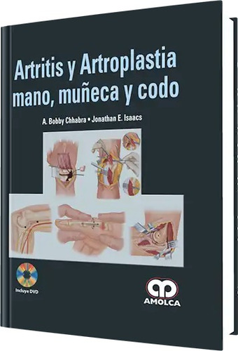 Artritis Y Artroplastia - Mano, Muñeca Y Codo Chhabra