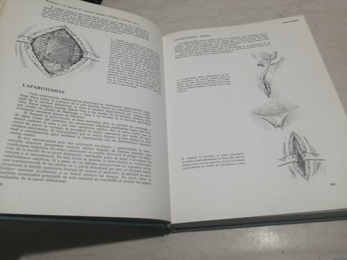 Libro. Atlas De Técnica Quirúrgica. Grewe. Kremer (Usado)