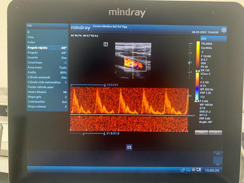 Ecografo Mindray Z50