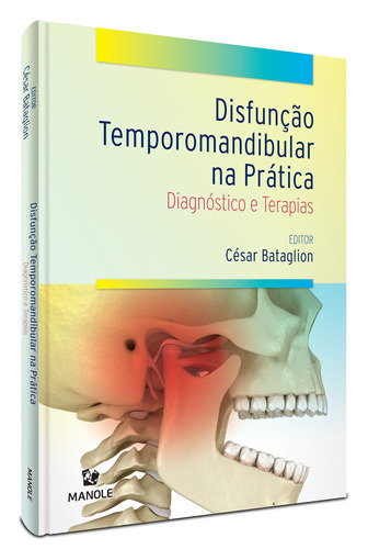 Disfunção temporomandibular na prática- diadnóstico e terapias, de () Bataglion, César. Editora Manole LTDA, capa dura em português, 2021