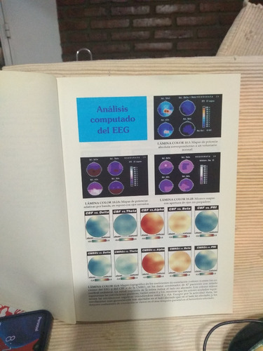 Análisis Computado Del Eeg - R. Ferrero, A. Ferrero (Usado)