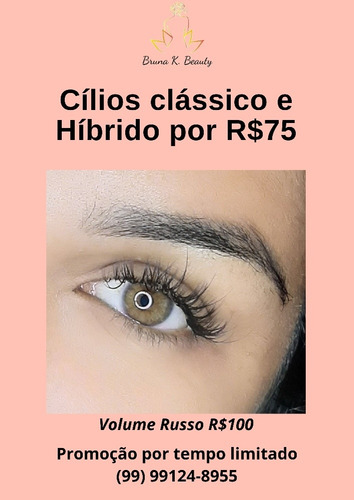 Imagem 2 de 2 de Remoção De Sinais E Extensão De Cilios.