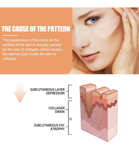 D Nackenfalten Augenfalten Feine Falten Crema Para La Cara