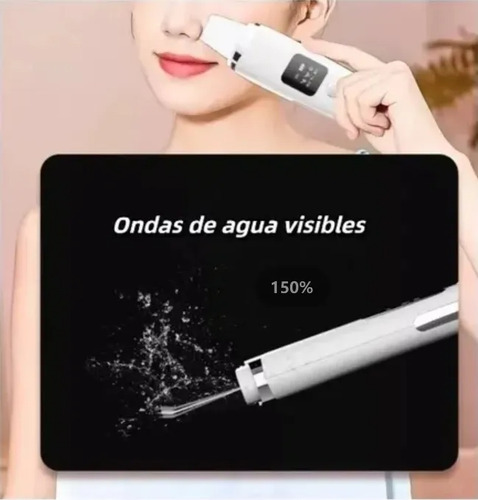 Limpiador Facial Ultrasónico 2 En 1 Con Exfoliador Ti Blanco