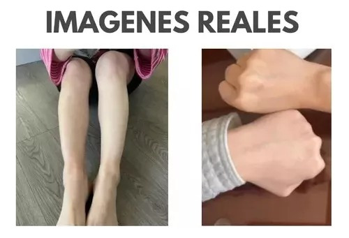 Crema Blanqueadora Aclaradora Partes Intimas, Ojeras Manchas