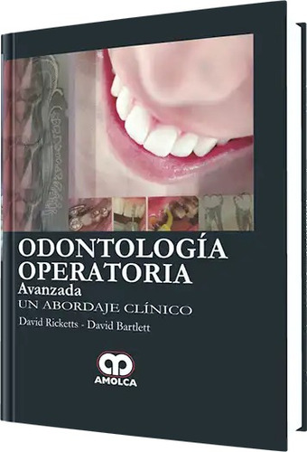 Odontología Operatoria Avanzada