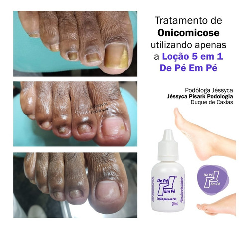 Locao De Pe Em Pe Amacia Hidrata Afina Trata E Protege