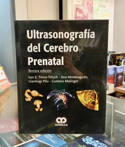 Ultrasonografía Del Cerebro Prenatal 3era Edición