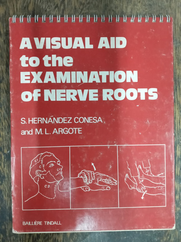 A Visual Aid To The Examination Of Nerve Roots * S. Conesa *