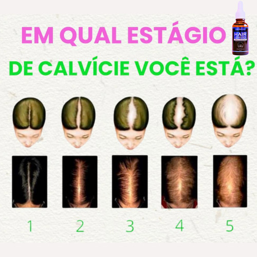 Tônico Fortalecedor Bomba Crescimento Nasce Cabelo Inovador